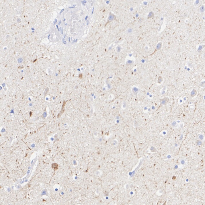 HA723977_4.jpg