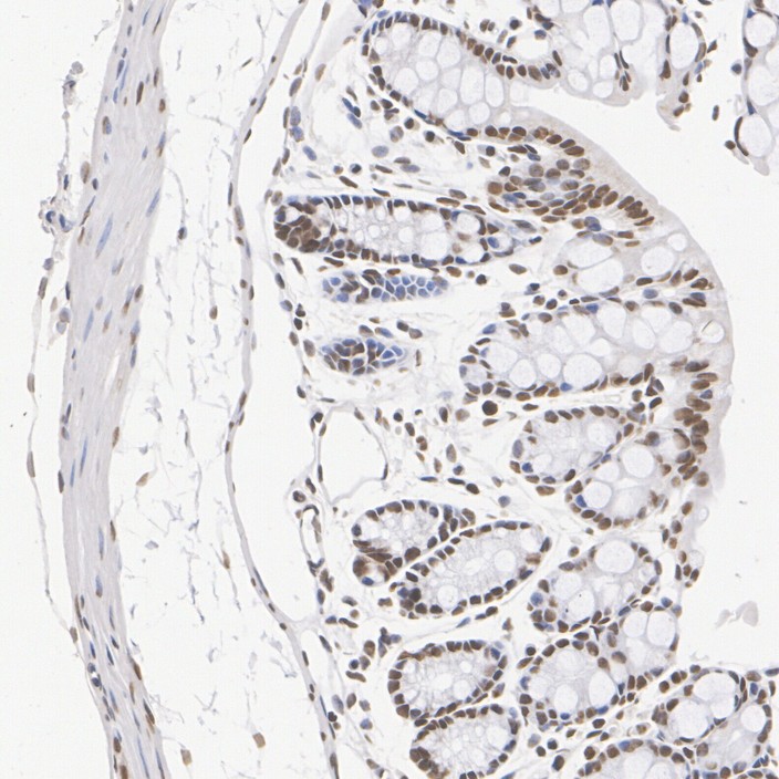 HA723983_6.jpg