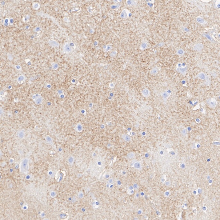 HA724114_2.jpg