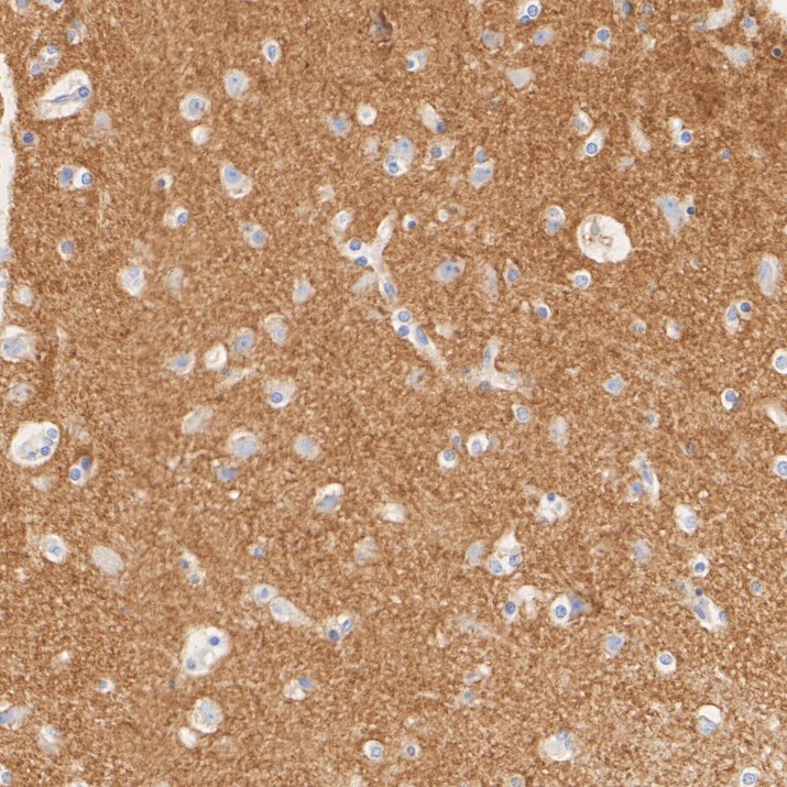 HA724148_4.jpg