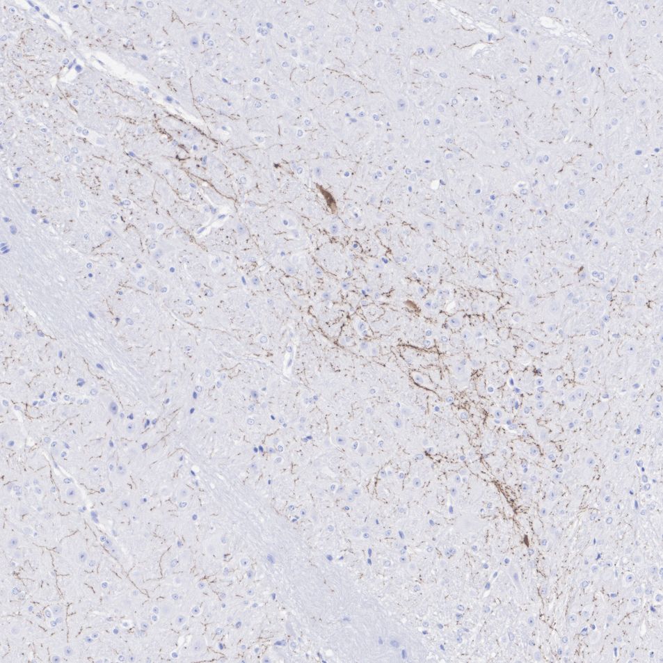 HA724406_5.jpg