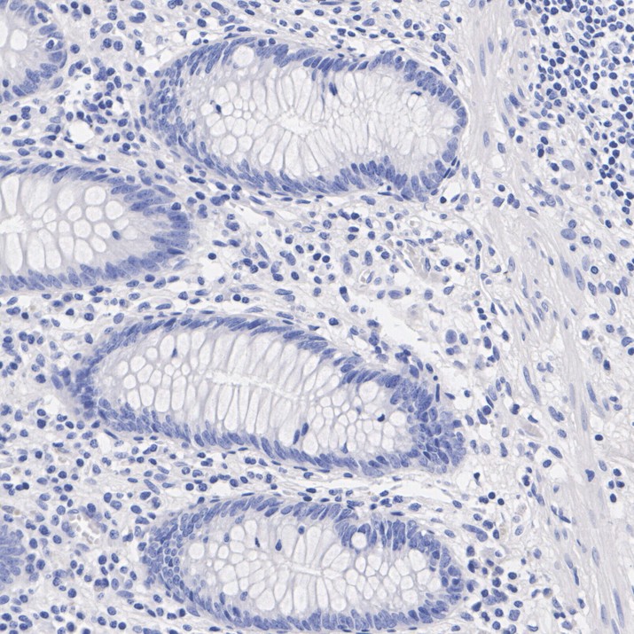 HA724492_4.jpg