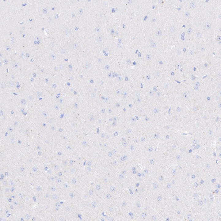 HA751103_3.jpg