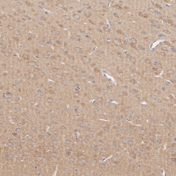 HA751251_4.jpg
