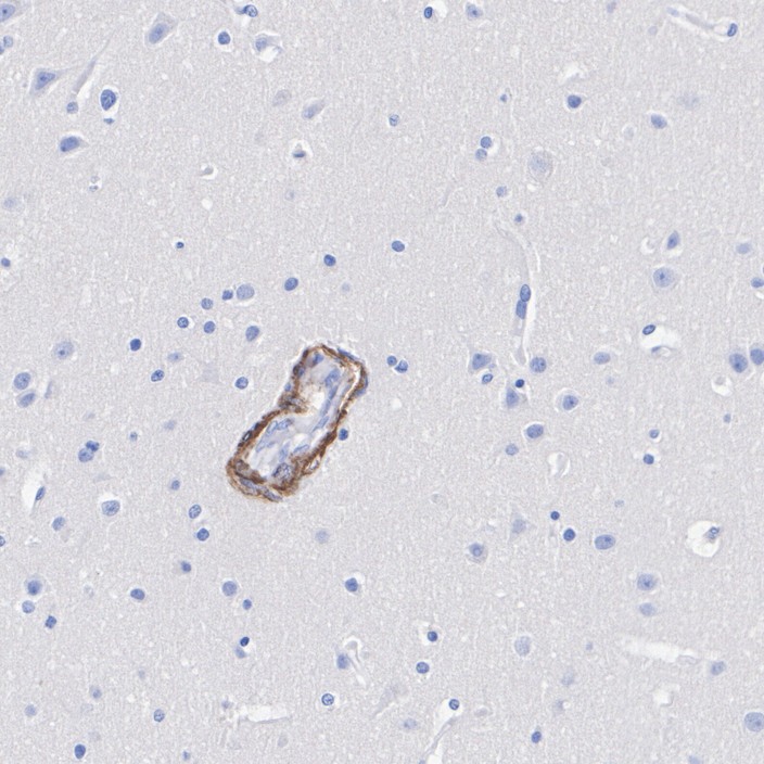 HA751325_2.jpg