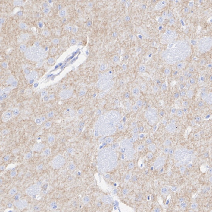 HA751325_5.jpg