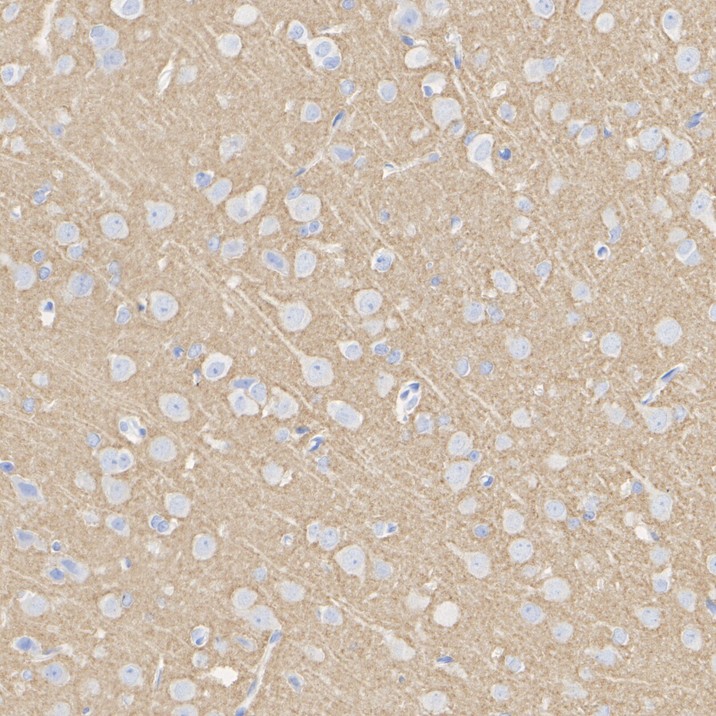 HA751356_11.jpg