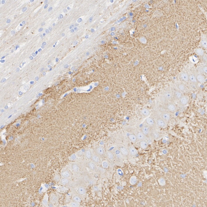 HA751356_12.jpg