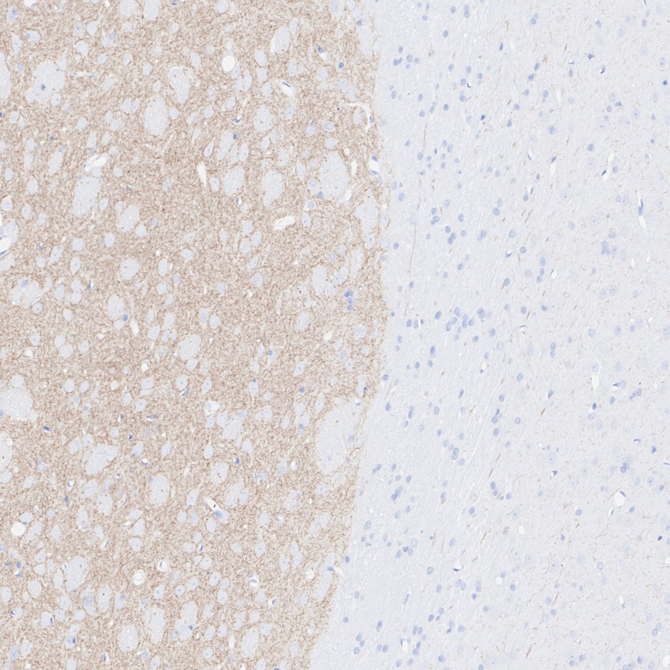 HA751358_5.jpg