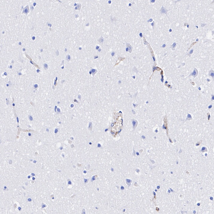 HA751408_4.jpg