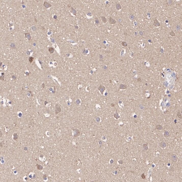 HA751432_2.jpg