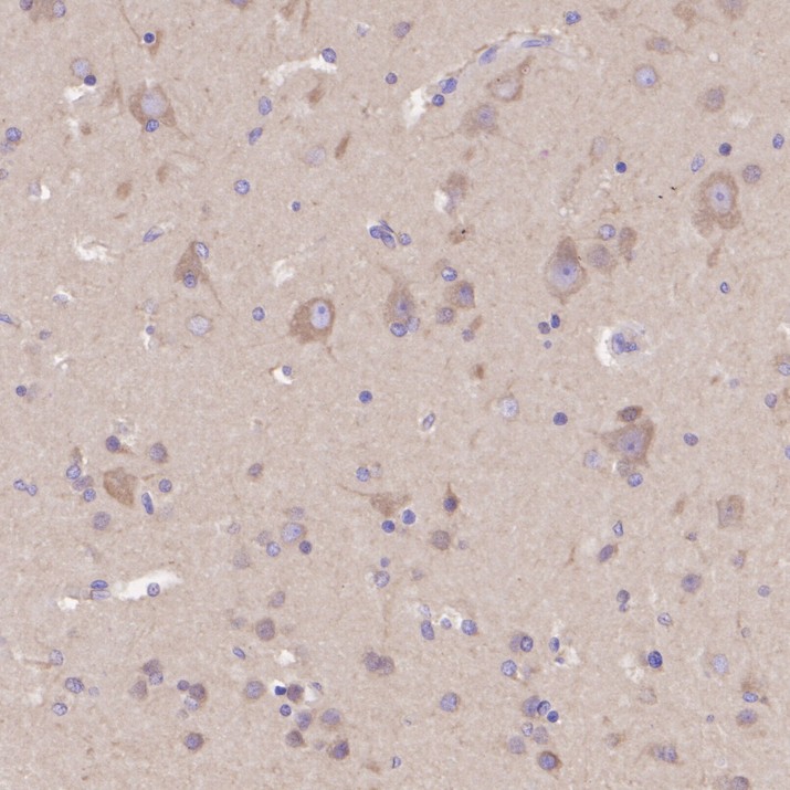 HA751464_4.jpg