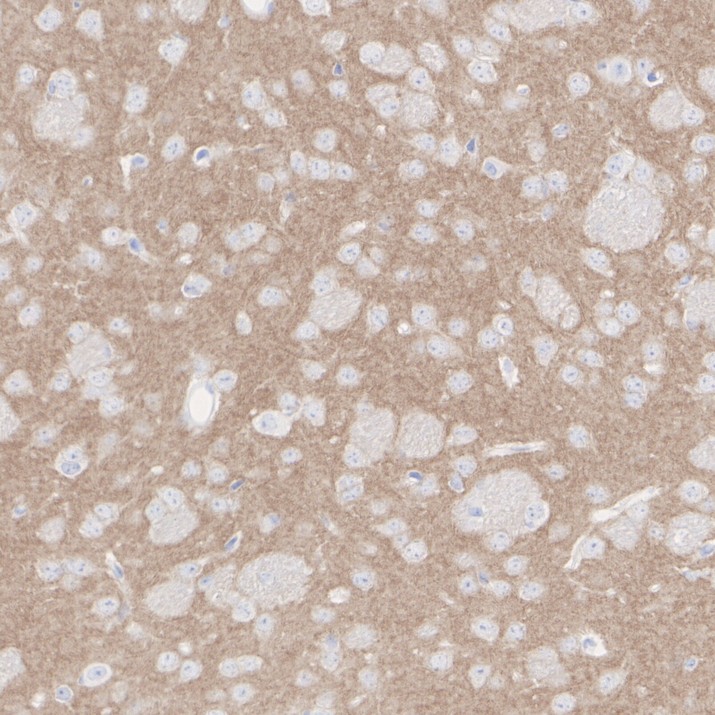 HA751470_2.jpg