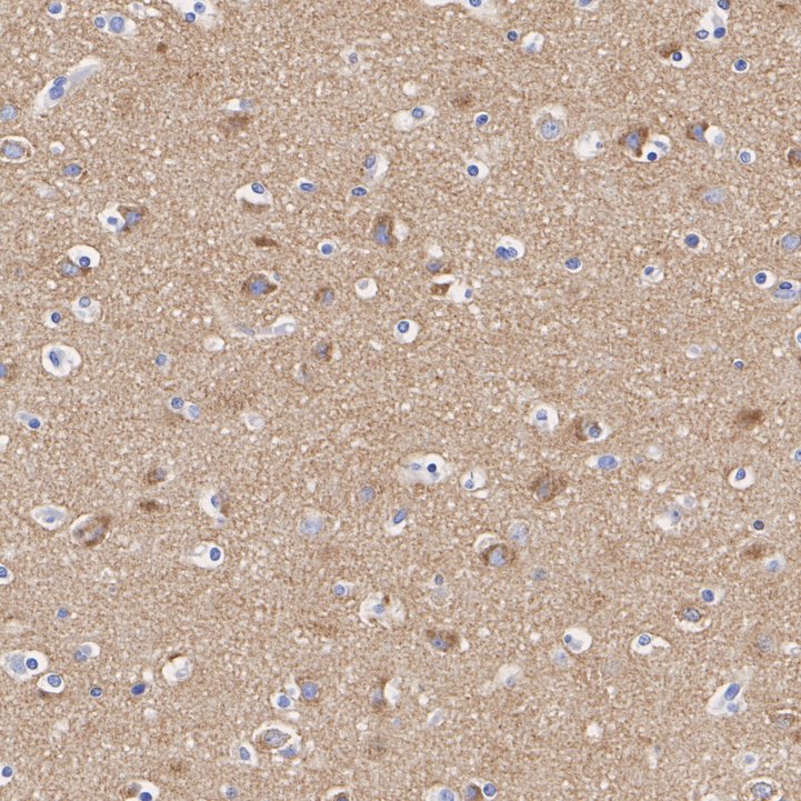 HA751613_2.jpg