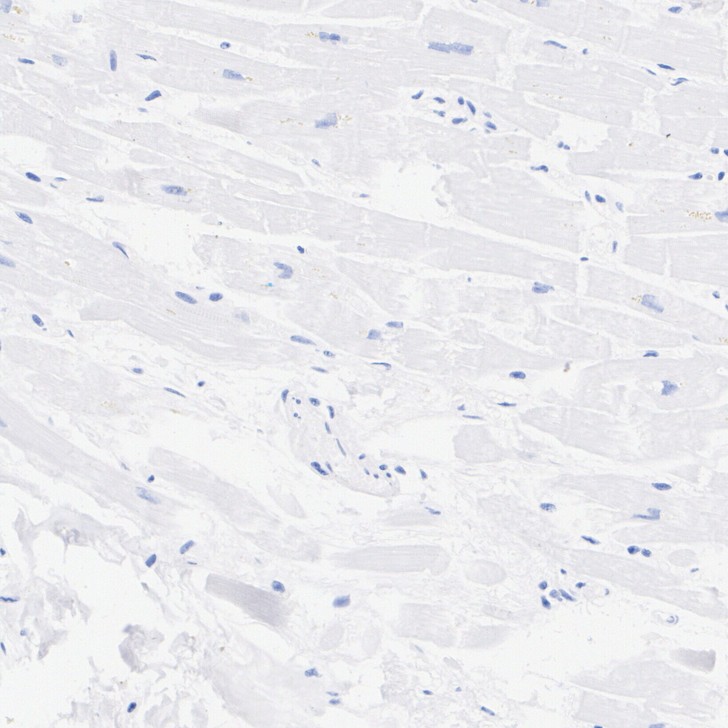 HA751613_6.jpg