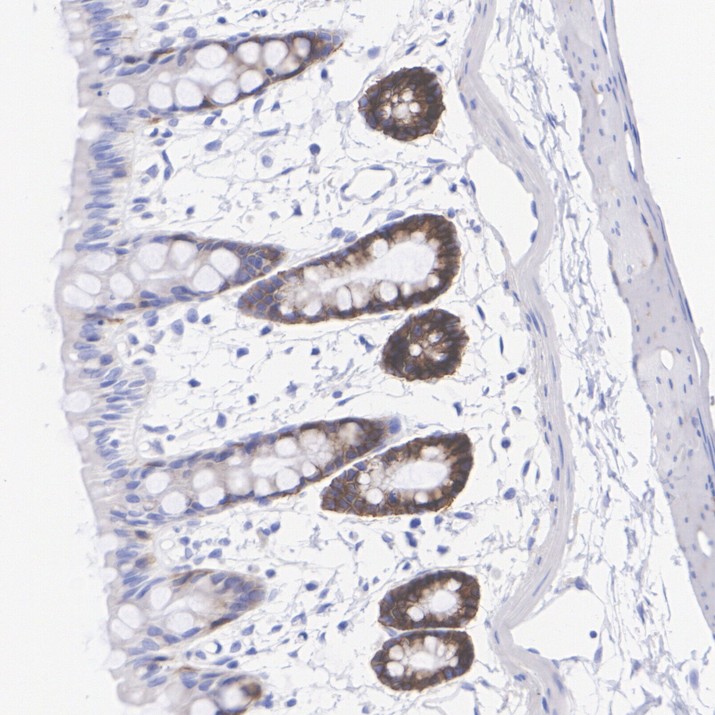 HA751906_11.jpg