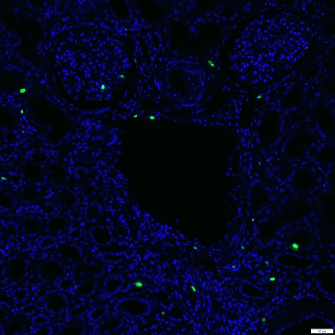 IRS036_6.jpg