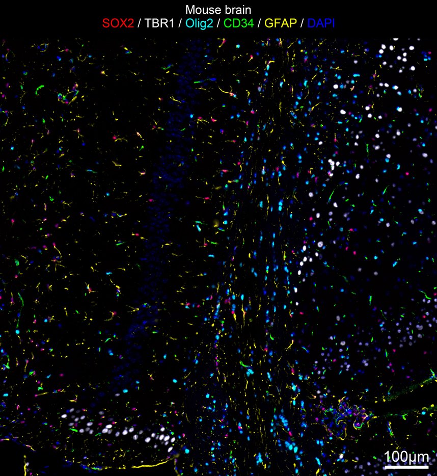 IRS067_1.jpg